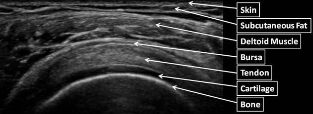 Taking a Deeper Look… Diagnostic MSK Ultrasound 1 Six Physio